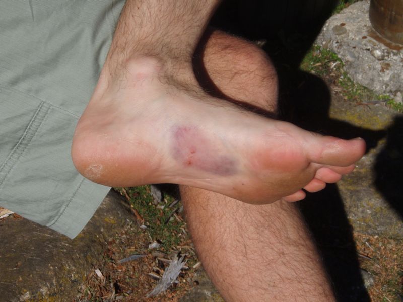 Sore Foot at Ironstone Hut.jpg